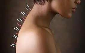 Paola Villanueva - Masoterapeuta, Acupunturista y Naturópata