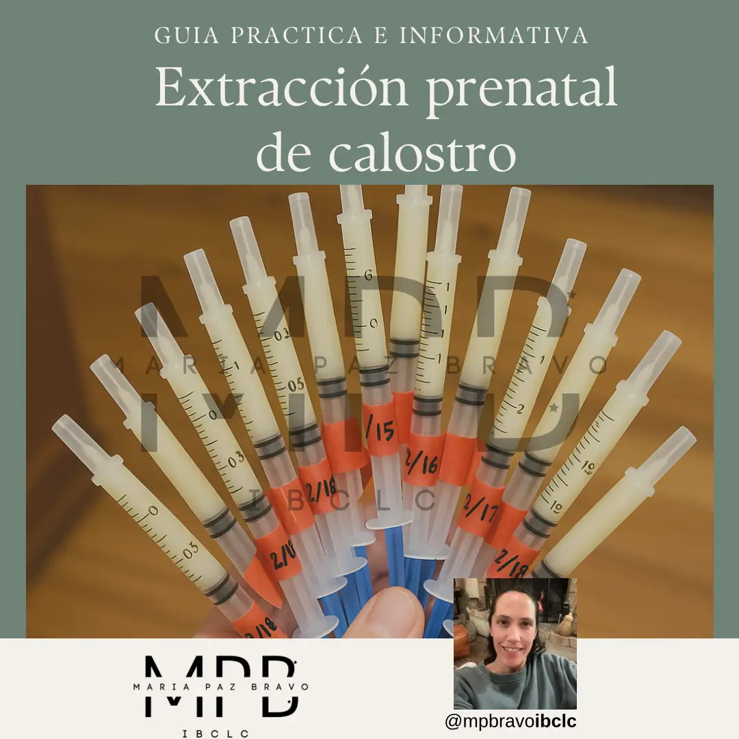 Guía extracción prenatal de calostro