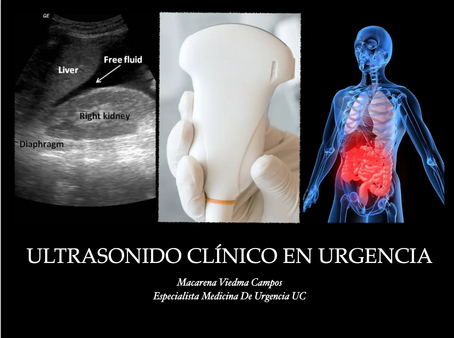 🥉 🩻🚑  Ultrasonido Clínico en Trauma . En Medicina de Urgencia. 