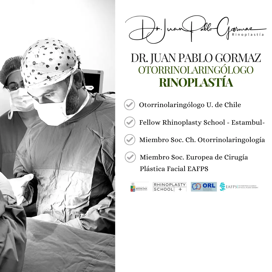 Dr. Juan Pablo Gormaz Bardavid - Otorrinolaringólogo - Rinoplastía de Precisión